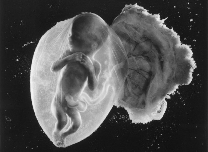 EMBRYO