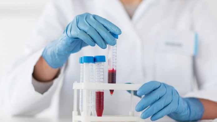 bacteria_test