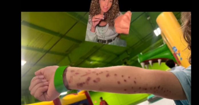 ΕΠΙΘΕΣΗ ΧΤΑΠΟΔΙ